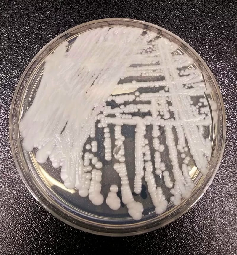 Fungal Infectious Waste – A Growing Concern
